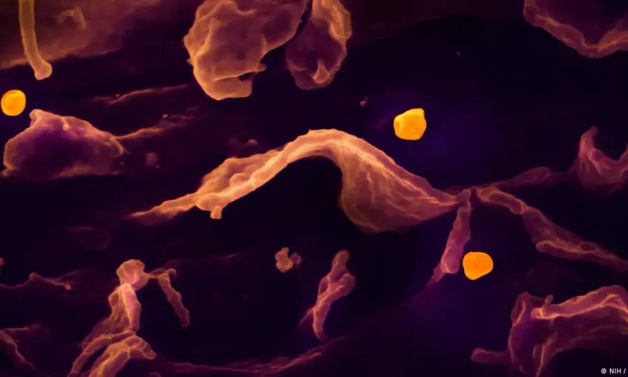 کیا نیپا وائرس عالمی وبا بن سکتا ہے؟