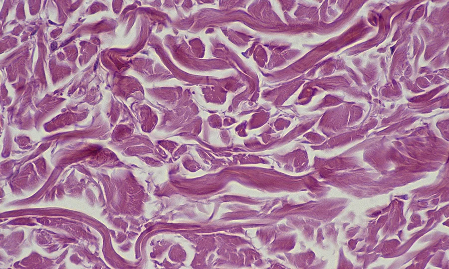 سائنسدانوں نے پرانے خلیات کو دوبارہ جوان کرنے کا ممکنہ طریقہ دریافت کرلیا