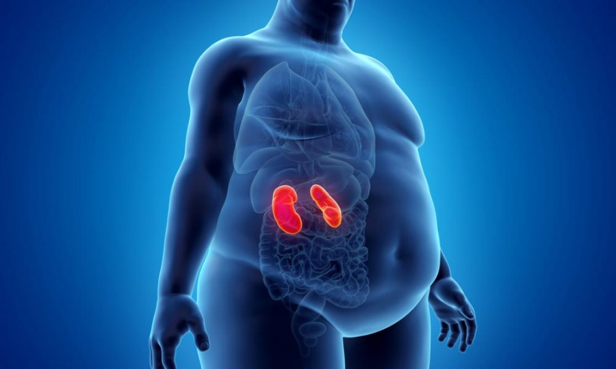 موٹاپے کا دوہرا کردار  : CKD کا سبب اور گردوں کی خرابی کا محرک