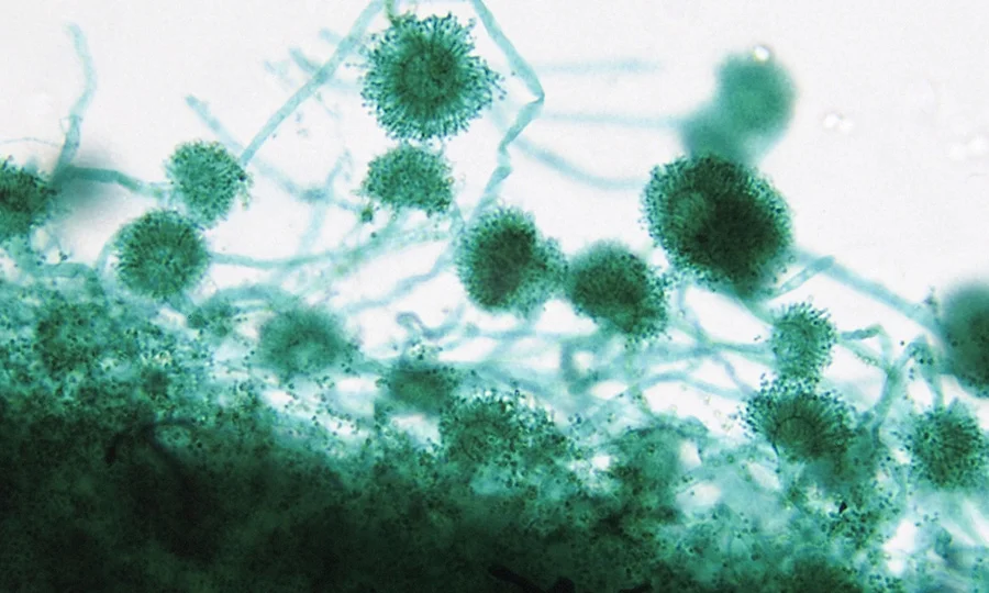 آسٹریلیا میں فنگس سے 2 افراد ہلاک؛ کیا یہ بیماری بھی جان لیوا ہوسکتی ہے؟