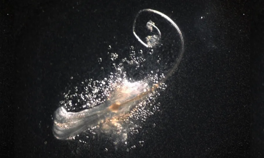 گنج پن کے علاج میں تاریخی پیش رفت؛ بالوں کے کار آمد فولیکلز تیار