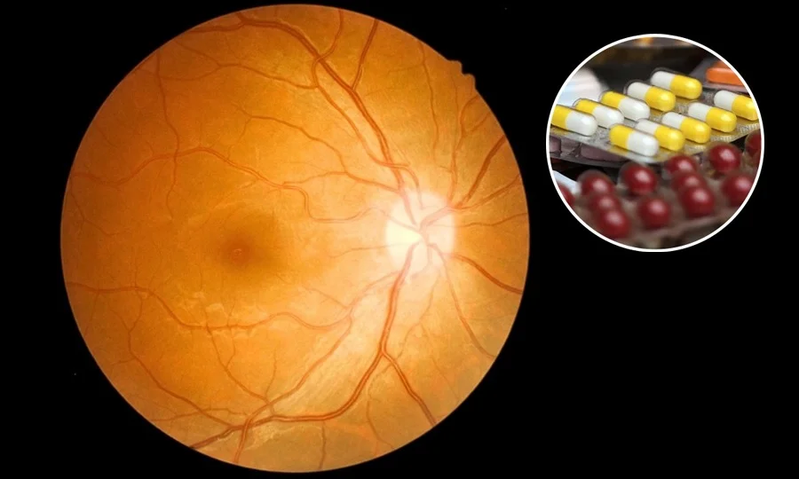 وزن کم کرنے والی دوا کے سنگین نتائج سامنے آنے لگے