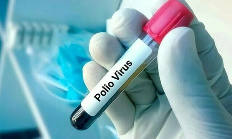 پولیو کے خلاف جنگ میں کامیابی؛ 2026 کے پہلے دو ماہ میں وائرس کی شرح میں نمایاں کمی
