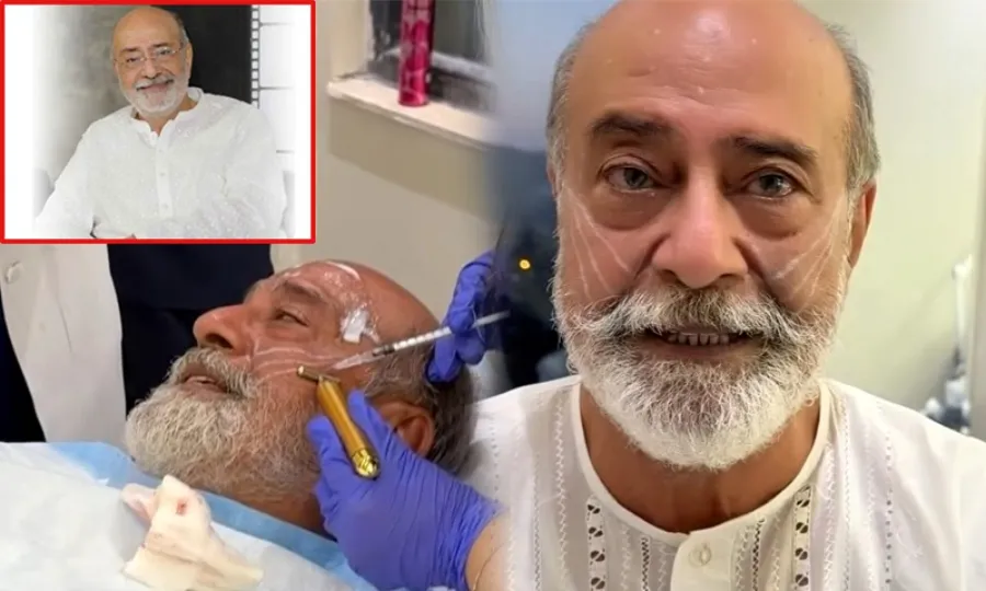 سینئر اداکار محمد احمد کی فیس لفٹ کی ویڈیو سوشل میڈیا پر وائرل