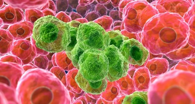 British scientists developed 'sugar bomb' to kill cancer cell