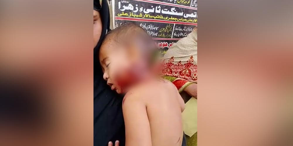 Stray dog in Okara shreds baby girl