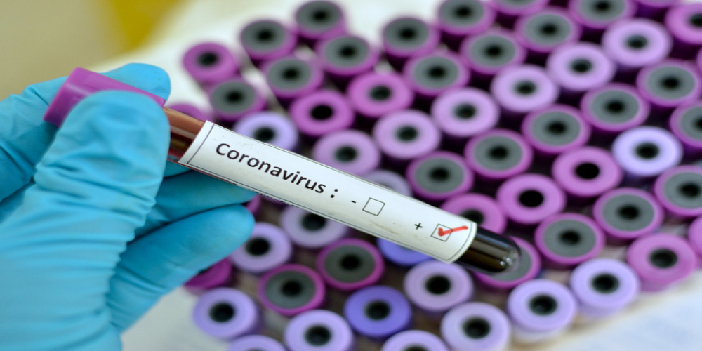 Coronavirus in Pakistan: Dr Zafar mirza confirms 2 cases