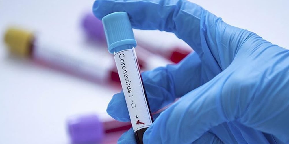 Coronavirus: Hospitals in Pakistan where People can get tests