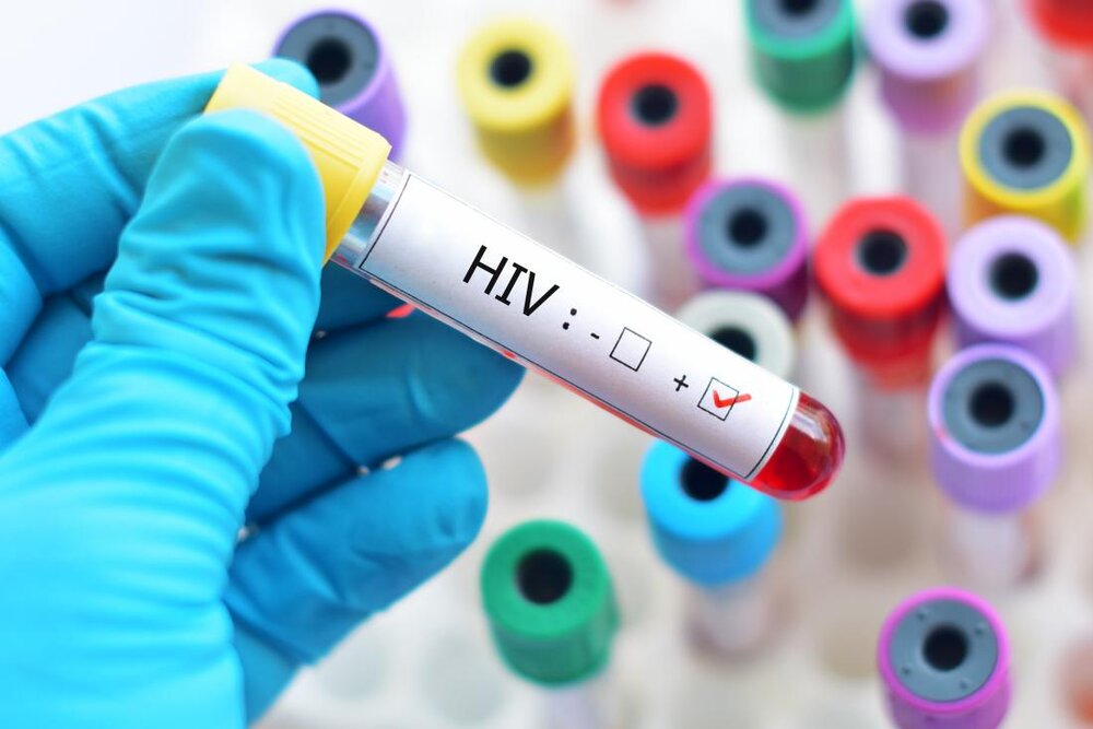 HIV transmission