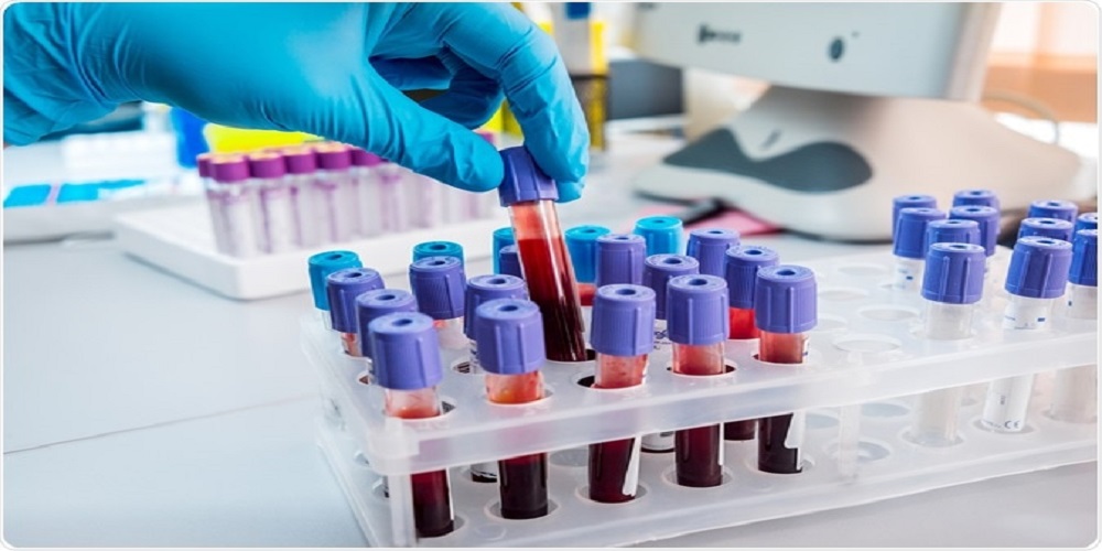 This new blood test can detect 50 types of cancer