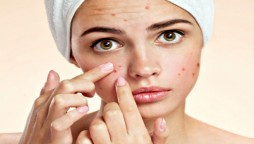 Tips to try when Acne doesn’t clear or leaves blemishes