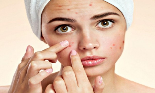 Tips to try when Acne doesn’t clear or leaves blemishes