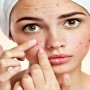 Tips to try when Acne doesn’t clear or leaves blemishes