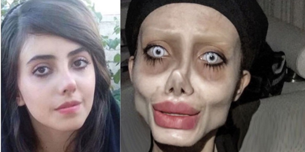 Iran's 'Angelina Jolie' contracts Coronavirus in jail