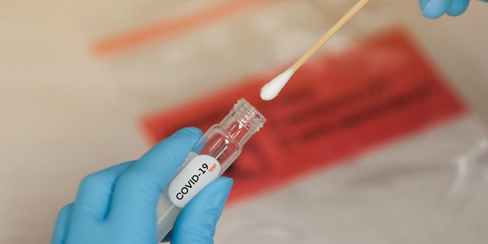 Coronavirus: Substandard tests can hamper govt’s efforts to control pandemic