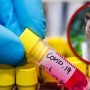 India: Monkeys snatch blood samples of Coronavirus patients from lab technicians