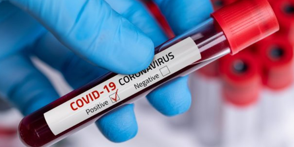 Coronavirus-Latin America becomes the new epicenter