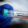 Coronavirus: Israel to begin mass trial of antibodies in next 2 weeks