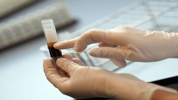 Coronavirus-Thousands to take part in plasma trial