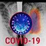 With an Artificial Intelligence Model COVID-19 can be detected in seconds