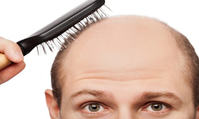 Baldness presents men extra exposed to critical COVID-19 indications