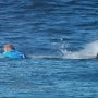 After being attacked by a shark, a Florida adolescent suffered a partial limb amputation