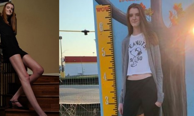 Girl with longest legs breaks two Guinness World Records