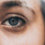Dark Circles: Main causes, home remedies – All you need to know