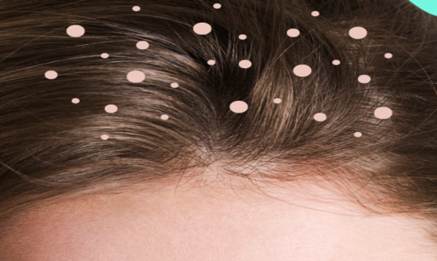Combat Scalp Sensitivity And Dryness As We Age