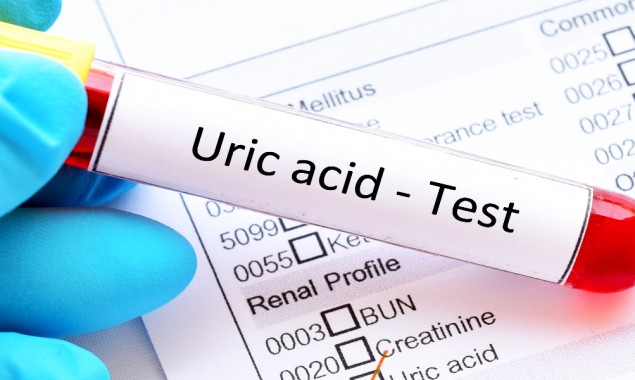 Research: Elevated Serum Uric Acid Decreasing Lifespan By 11 Years