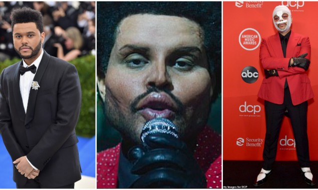 Did The Weeknd Get Plastic Surgery?