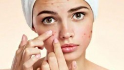 Acne home remedies