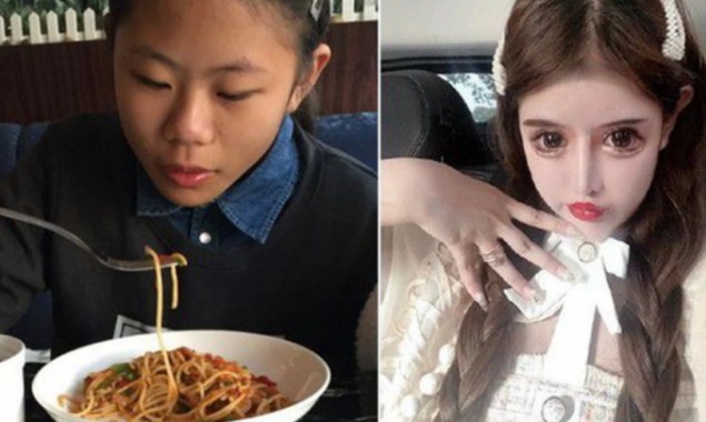 This 16-Year-Old Girl Undergoes 100 Cosmetic Procedures in 3 Years