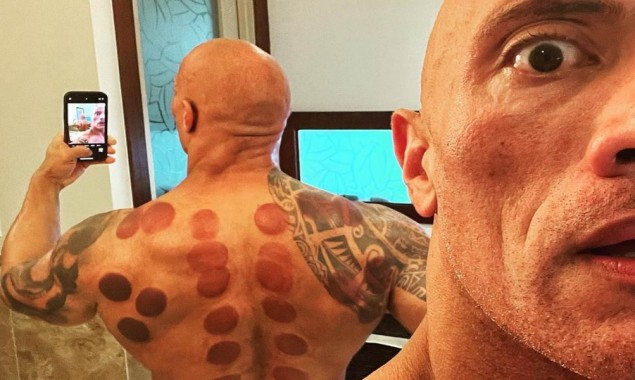 Dwayne Johnson undergoes cupping therapy for the first time