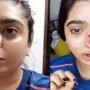 Watch: Bengaluru Woman Hit By Indian Delivery Man