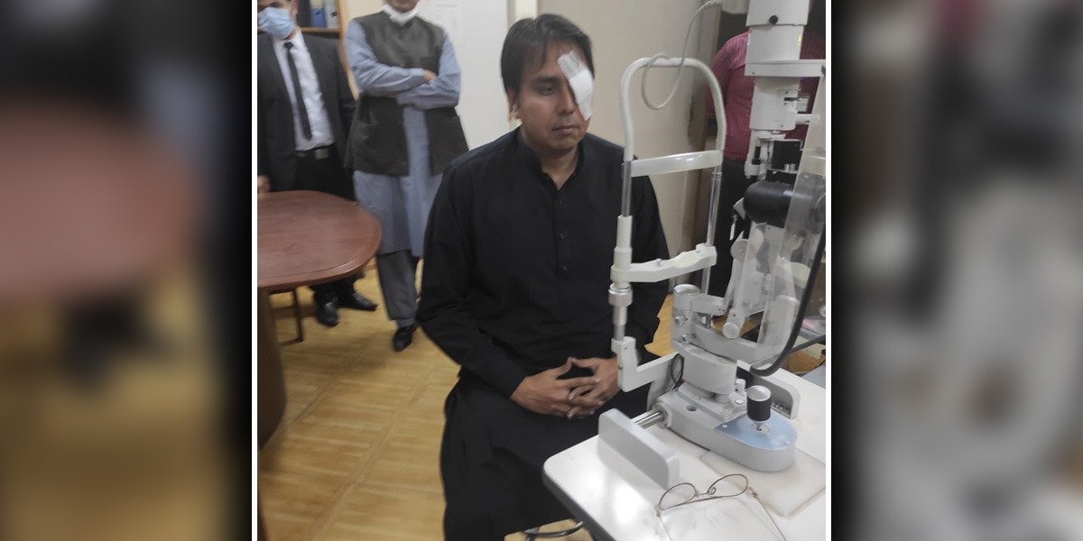 Shahbaz Gill egg ink