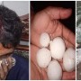 Heavy Rains Hit Large Part Of Punjab, Man Injured By Softball-Sized Hail