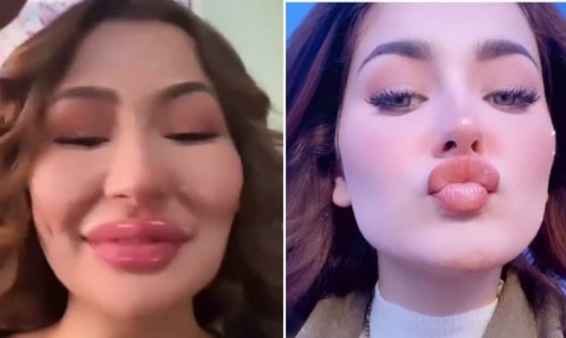 Hania Aamir plastic surgery