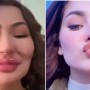 Hania Aamir Undergoes Plastic Surgery? Find Out!