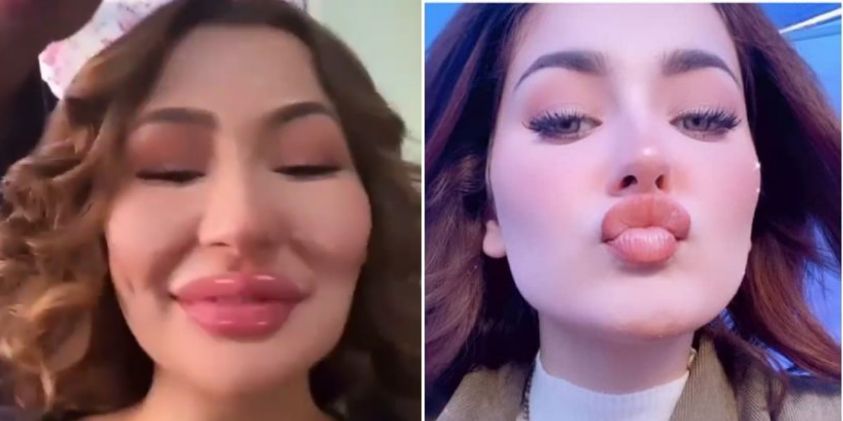 Hania Aamir plastic surgery