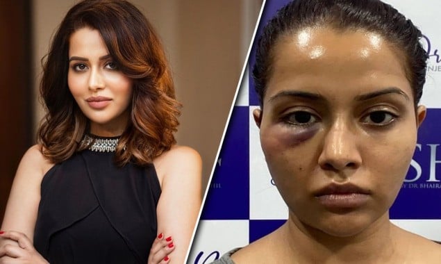 Famous Indian Actress Regrets Having Facial