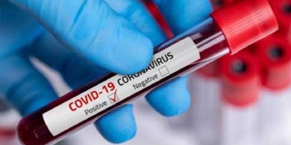 PSL 6: Two Covid-19 tests are performed on Pakistani players in the UAE