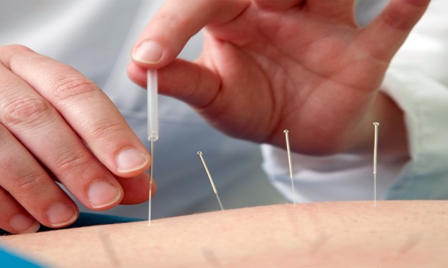 Acupuncture Is Effective for COVID Stress Relief
