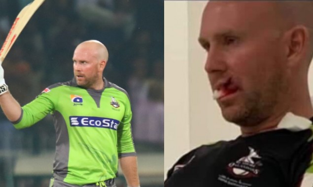 Ben Dunk Undergoes Lip Surgery Ahead Of PSL 6 Resumption