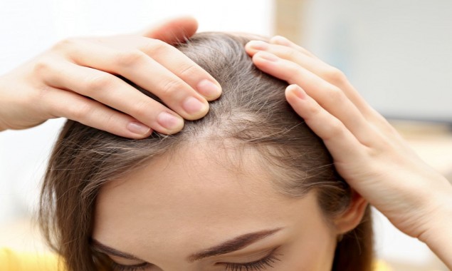 How to prevent balding? Here are 5 simple tips