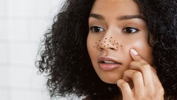 No more Difficulty in Removing Blackheads with this Homemade Scrub