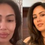 Shahid Kapoor’s wife Mira Rajput got lip surgery?