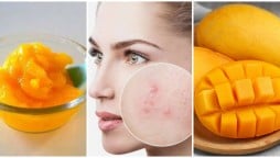 Use This Mango Pulp Mask To Get Clear Pimple Free Skin