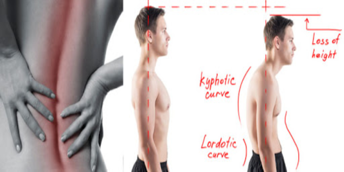 Exercises To Avoid Poor Posture