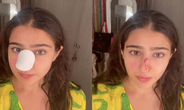 ‘Naak kaat di maine’ says Sara Ali Khan as her nose gets severely injured